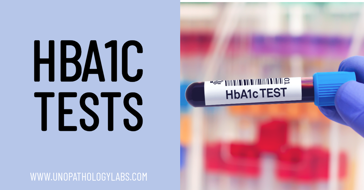 HbA1c Test